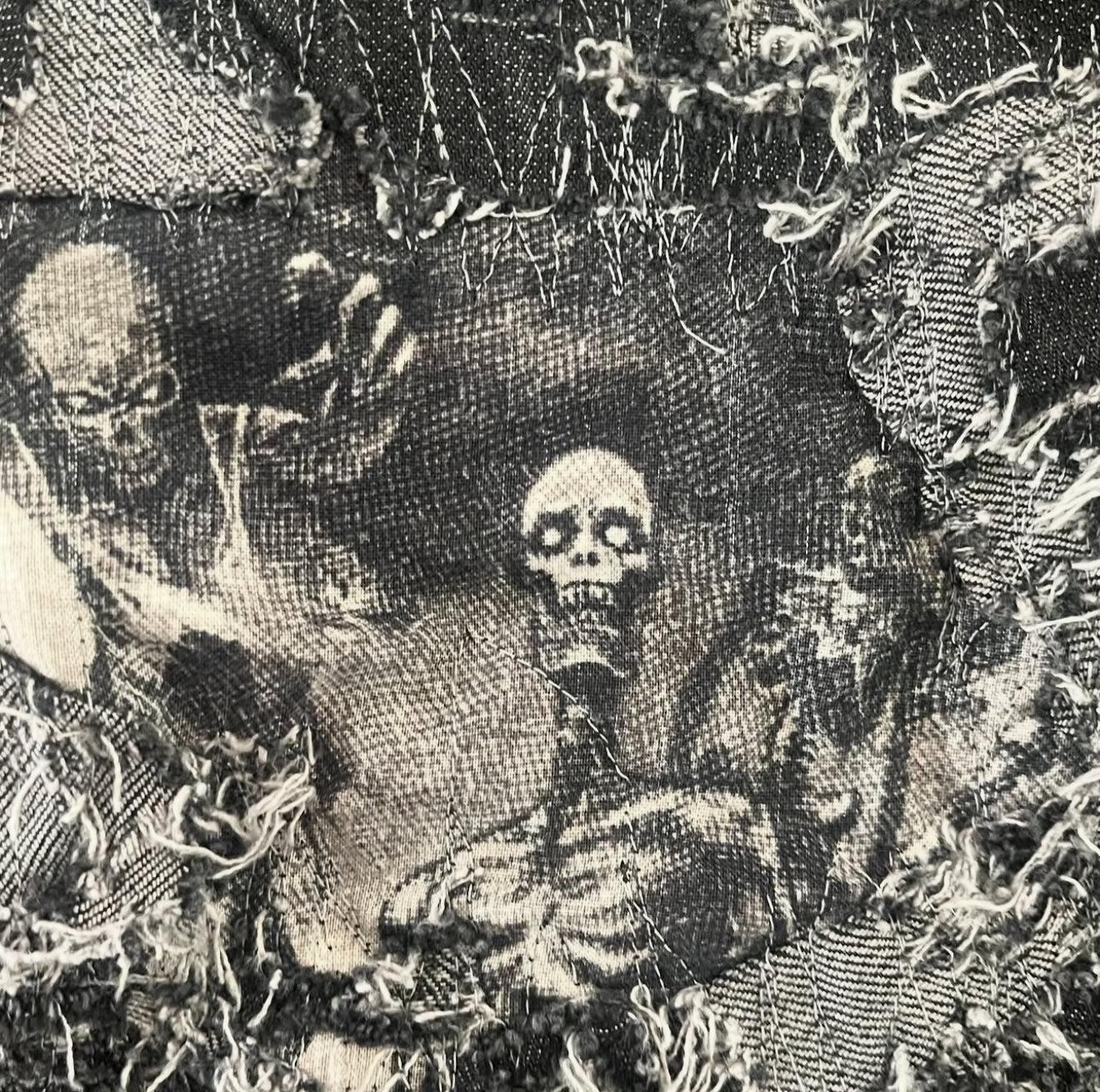 MYHM Skeletal damage